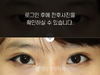 절개법 쌍꺼풀수술