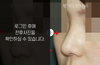화살코