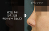 낮은코성형