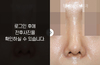 코재수술