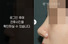 코재수술