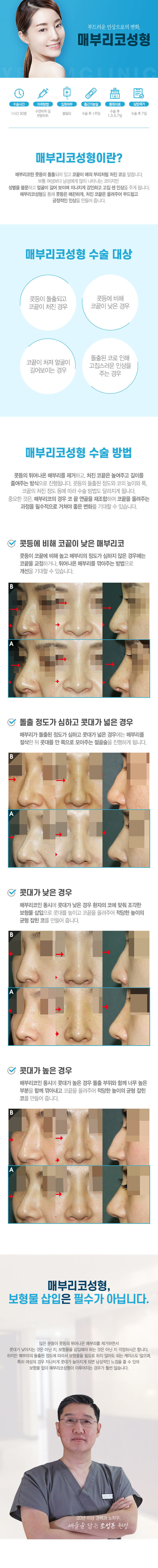이미지명